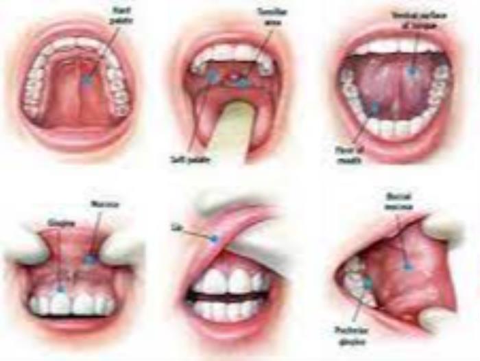 mouth or oral cancer treatment in India