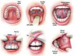 Oral or Mouth Cancer Treatment in India