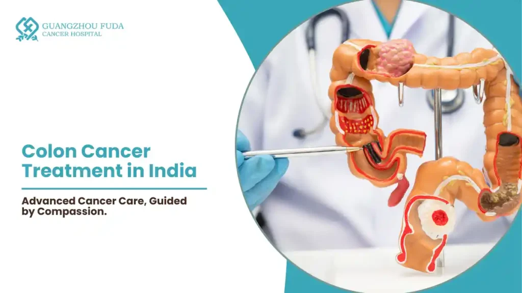 Colon Cancer Treatment in India