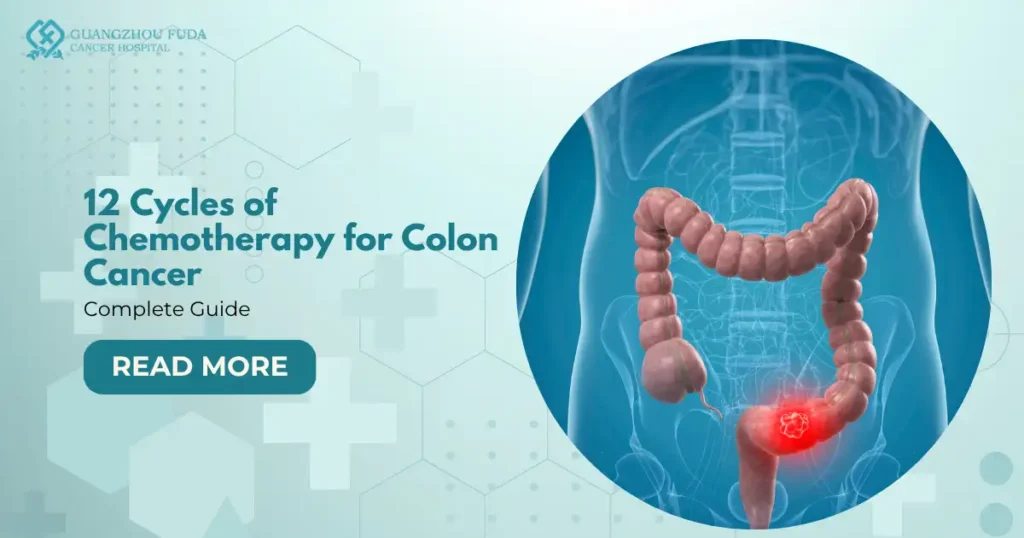 12 Cycles of Chemotherapy for Colon Cancer
