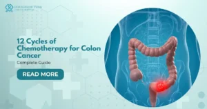 12 Cycles of Chemotherapy for Colon Cancer