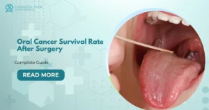 Oral Cancer Survival Rate After Surgery: What Patients Should Know