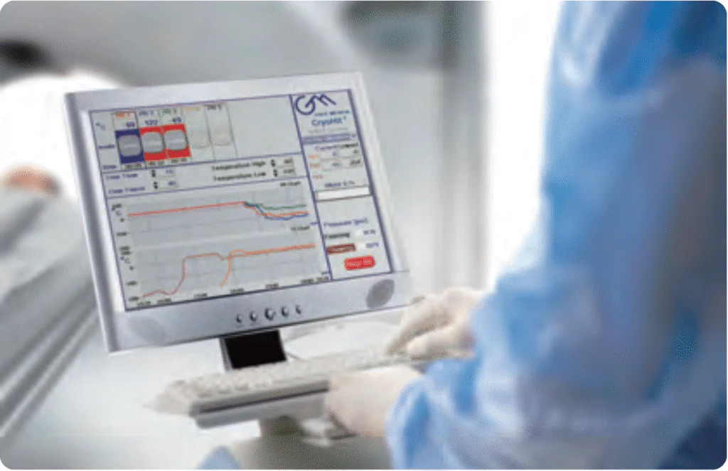 Cryosurgery Procedure