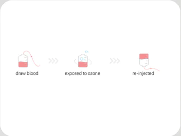 Ozone Therapy Illustration